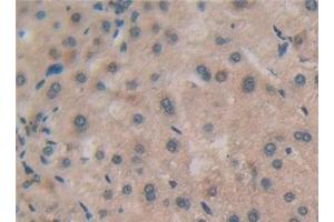 Detection of RSPO1 in Human Liver Tissue using Polyclonal Antibody to R-Spondin 1 (RSPO1)