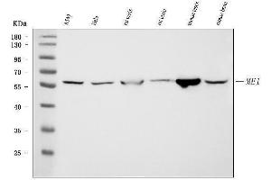 Western blot analysis of ME1 using anti-ME1 antibody (ABIN7599485).