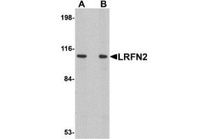 Western Blotting (WB) image for anti-Leucine Rich Repeat and Fibronectin Type III Domain Containing 2 (LRFN2) (C-Term) antibody (ABIN1030490) (LRFN2 anticorps  (C-Term))
