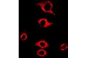 Immunofluorescent analysis of RPL9 staining in MCF7 cells. (RPL9 anticorps)