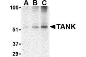 Western blot analysis of TANK in Daudi cell lysate with this product at (A) 0. (TANK anticorps  (C-Term))
