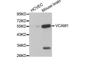 Western blot analysis of extracts of various cell lines, using VCAM1 antibody. (VCAM1 anticorps  (AA 300-400))