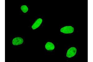 Immunofluorescence of monoclonal antibody to FOXQ1 on HeLa cell.