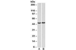 Western blot testing of human A) HeLa and B) MCF7 cell lysate with PRKACA antibody at 2ug/ml. (PRKACA anticorps)