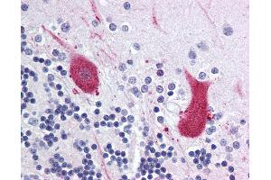 Anti-MARK1 antibody IHC of human brain, cerebellum.