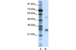 Western Blotting (WB) image for anti-Leucine Rich Repeat Containing 14 (LRRC14) antibody (ABIN2461029) (LRRC14 anticorps)
