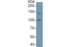 Detection of PLCb4 in Human A549 cell lysate using Polyclonal Antibody to Phospholipase C Beta 4 (PLCb4) (Phospholipase C beta 4 anticorps  (AA 2-250))