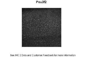 Sample Type :  Mouse adult cortex  Primary Antibody Dilution :  1:1000  Secondary Antibody :  Donkey anti rabbit IgG Alexa 594  Secondary Antibody Dilution :  1:1000  Gene Name :  POU3F2   Submitted by :  Dr.