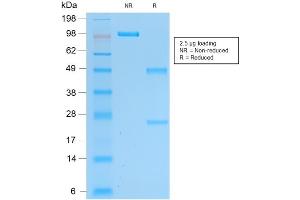SDS-PAGE Analysis of Purified UCHL1 Mouse Recombinant Monoclonal Antibody ABIN6383833.