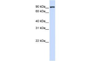 WB Suggested Anti-CTAGE5 Antibody Titration:  0. (MIA2 anticorps  (Middle Region))