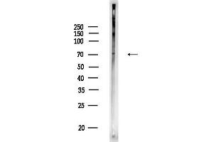 Western blot analysis of lysates from Rat testis, using CNG Antibody at 1/1000 dilution.
