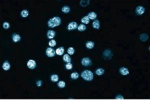 Immunofluorescence staining of HL-60 cells (Human promyelocytic leukemia, ATCC CCL-240). (Plakophilin 2 anticorps  (AA 19-183))