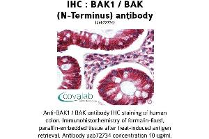 Image no. 1 for anti-BCL2-Antagonist/killer 1 (BAK1) (N-Term) antibody (ABIN1732215) (BAK1 anticorps  (N-Term))