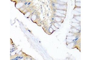 Immunohistochemistry of paraffin-embedded Human colon using LRG1 Polyclonal Antibody at dilution of 1:100 (40x lens). (LRG1 anticorps)
