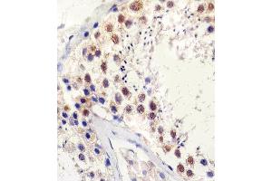 Immunohistochemical analysis of paraffin-embedded H. (TBP anticorps)