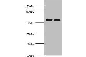 Western blot All lanes: CDK16 antibody at 5 μg/mL Lane 1: Mouse brain tissue Lane 2: Mouse small intestineSecondary Goat polyclonal to rabbit IgG at 1/10000 dilution Predicted band size: 56, 64, 57 kDa Observed band size: 56 kDa (CDK16 anticorps  (AA 277-496))