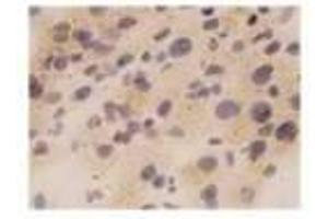Image no. 2 for anti-Tumor Necrosis Factor alpha (TNF alpha) antibody (ABIN791557) (TNF alpha anticorps)