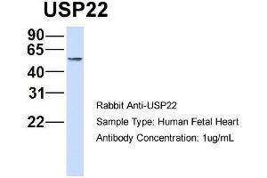 Host: Rabbit   Target Name: USP22   Sample Tissue: Human Fetal Heart  Antibody Dilution: 1. (USP22 anticorps  (Middle Region))