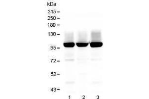 Western blot testing of GLUR2 antibody and Lane 1:  rat brain (GRIA2 anticorps  (AA 25-360))