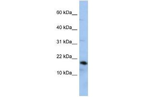 WB Suggested Anti-LCN1 Antibody Titration: 0.