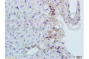 Formalin-fixed and paraffin-embedded mouse liver tissue labeled with Rabbit Anti-TNFSF14 Polyclonal Antibody, Unconjugated (ABIN740625) 1:200 followed by conjugation to the secondary antibody and DAB staining (TNFSF14 anticorps  (AA 141-240))