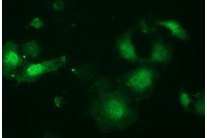 Anti-LIN7B mouse monoclonal antibody (ABIN2453853) immunofluorescent staining of COS7 cells transiently transfected by pCMV6-ENTRY LIN7B (RC205598). (LIN7B anticorps)