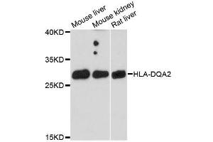 Western blot analysis of extracts of various cell lines, using HLA-DQA2 antibody (ABIN5996485) at 1:3000 dilution.