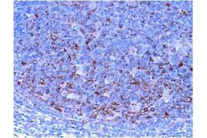 Immunohistochemistry (IHC) image for anti-Checkpoint Kinase 1 (CHEK1) antibody (ABIN487487)