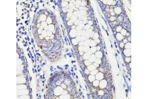 Immunohistochemistry of paraffin-embedded Human colon using PDCD10 Polyclonal Antibody at dilution of 1:100 (40x lens). (PDCD10 anticorps)