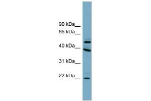 C4ORF20 antibody used at 1 ug/ml to detect target protein. (UFSP2 anticorps  (Middle Region))