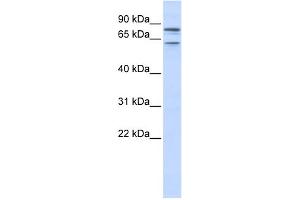 WB Suggested Anti-KCNQ1 Antibody Titration:  0. (KCNQ1 anticorps  (N-Term))