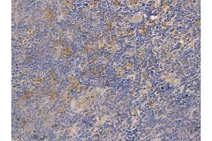 ABIN6263001 and ABIN6266814 at 1/100 staining human normal tonsil tissue by IHC-P. (LRAT anticorps  (Internal Region))
