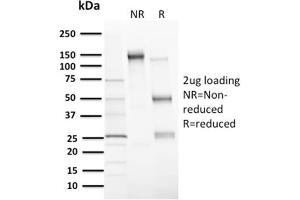 SDS-PAGE Analysis Purified MDM2 Mouse Monoclonal Antibody (MDM2/2414). (MDM2 anticorps  (AA 126-254))