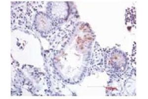 Immunohistochemistry (IHC) image for anti-Defensin beta 2 (BD-2) (AA 4-41) antibody (ABIN191996)