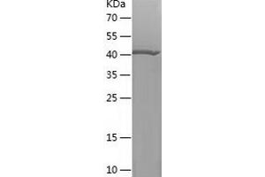 Western Blotting (WB) image for GTPase Activating Protein (SH3 Domain) Binding Protein 1 (G3BP1) (AA 278-466) protein (His-IF2DI Tag) (ABIN7123226)
