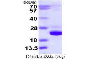 SDS-PAGE (SDS) image for RAB24, Member RAS Oncogene Family (RAB24) (AA 1-203) protein (His tag) (ABIN667586) (RAB24 Protein (AA 1-203) (His tag))
