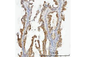 IHC analysis of ZMYND8 using anti-ZMYND8 antibody (ABIN7598947).