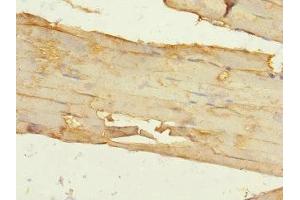 Immunohistochemistry of paraffin-embedded human skeletal muscle tissue using ABIN7156429 at dilution of 1:100