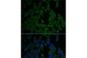 Immunofluorescence analysis of HeLa cells using NF2 Polyclonal Antibody