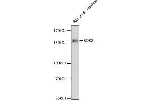 Western blot analysis of extracts of rat small intestine, using ROR2 antibody (ABIN7269889) at 1:1000 dilution.