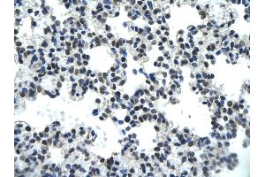 Rabbit Anti-PSIP1 antibody        Paraffin Embedded Tissue:  Human Lung cell   Cellular Data:  Epithelial cells of renal tubule  Antibody Concentration:   4.