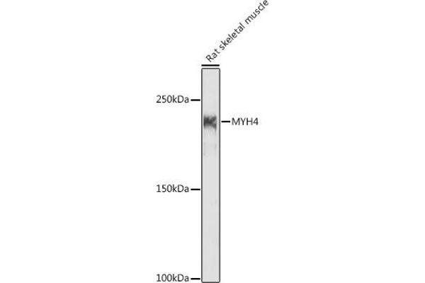 MYH4 anticorps  (AA 1450-1550)