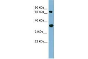 anti-Protein Phosphatase 2, Regulatory Subunit A, beta (PPP2R1B) (AA 35-84) antibody