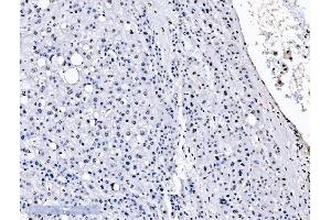IHC analysis of splicing factor 1 using anti-splicing factor 1 antibody (ABIN7600193). (Splicing Factor 1 anticorps  (AA 160-266))
