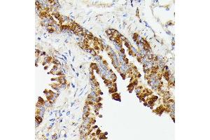 Immunohistochemistry of paraffin-embedded mouse lung using PTP4 antibody (ABIN7269703) at dilution of 1:100 (40x lens).