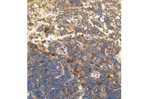 Immunohistochemistry of paraffin embedded mouse lymph node using CD30 (ABIN7076073) at dilution of 1:600 (400x lens)