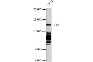 Western blot analysis of extracts of MCF7 cells, using FAK pAb (ABIN6131637, ABIN6135867, ABIN6135868 and ABIN7101374) at 1:1000 dilution. (FAK anticorps)