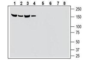 Western blot analysis of mouse kidney membranes (lanes 1 and 5), rat pancreas lysates (lanes 2 and 6), mouse brain membranes (lanes 3 and 7) and rat brain lysate (lanes 4 and 8): - 1-4. (SLC28A3 anticorps  (5th Extracellular Loop))