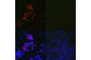 Immunofluorescence analysis of 293T cells using MLC3B Mouse mAb (ABIN7268520) at dilution of 1:100 (40x lens).