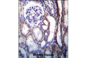 ATP6V1B1 Antibody immunohistochemistry analysis in formalin fixed and paraffin embedded human kidney tissue followed by peroxidase conjugation of the secondary antibody and DAB staining. (ATP6V1B1 anticorps  (AA 284-310))